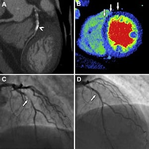 Read more about the article Comprehensive Cardiac Diagnosis for Patients with Coronary Stents